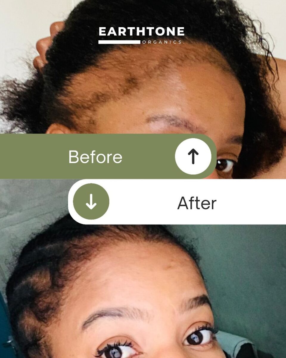 Organic Hair Products | Oraganic Natural Hair Products | Organic Products Hair | Organic African Hair Products | Organic Hair Products for Fine Hair | Best Organic Hair Products